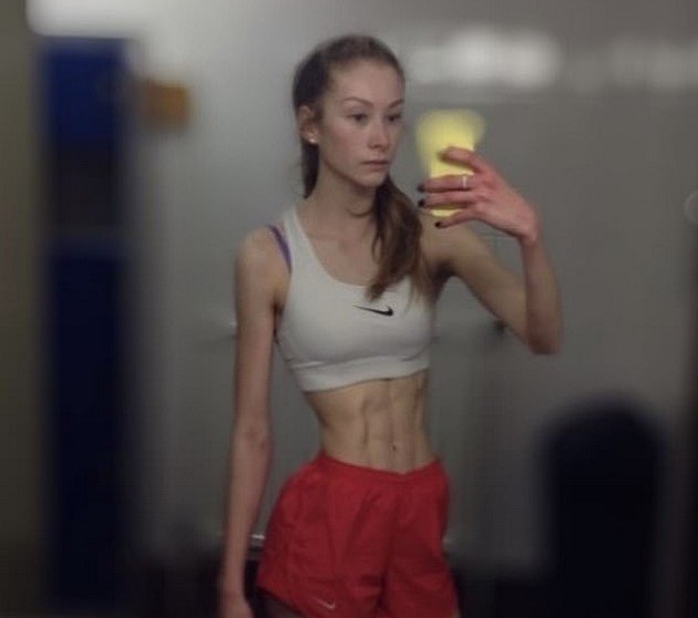 She weighed 72 pounds and is now a bodybuilder - A 21-year-old girl beat bulimia with exercise 3