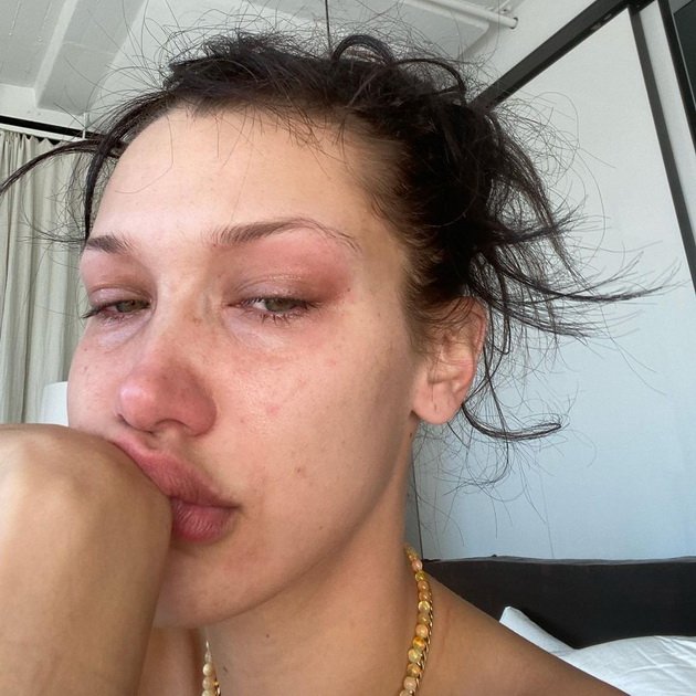 With tears in her eyes Bella Hadid spoke about mental health: "I feel guilty that I have depression"