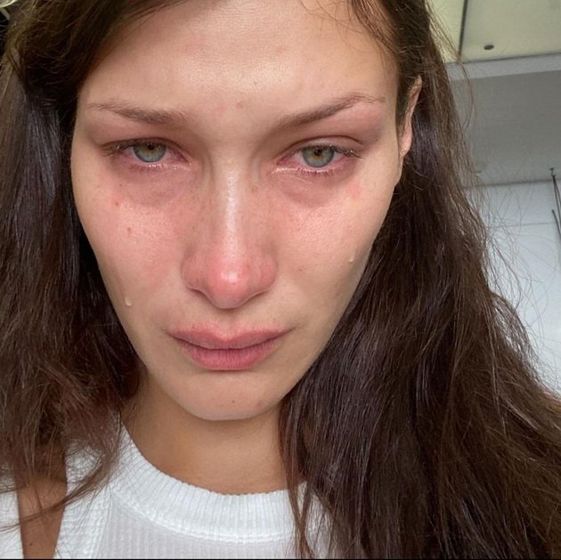 With tears in her eyes Bella Hadid spoke about mental health: "I feel guilty that I have depression"