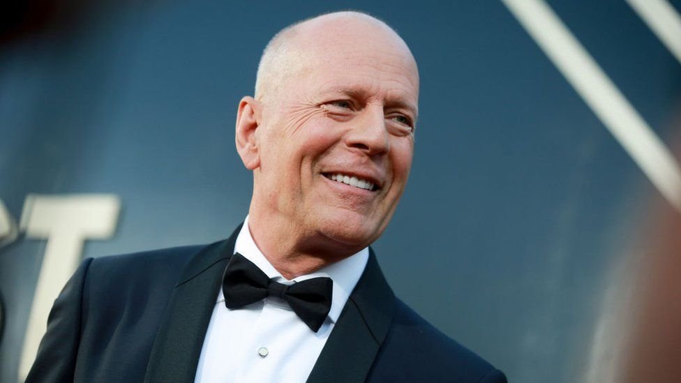 Bruce Willis quits acting due to a disease that impairs speech and comprehension