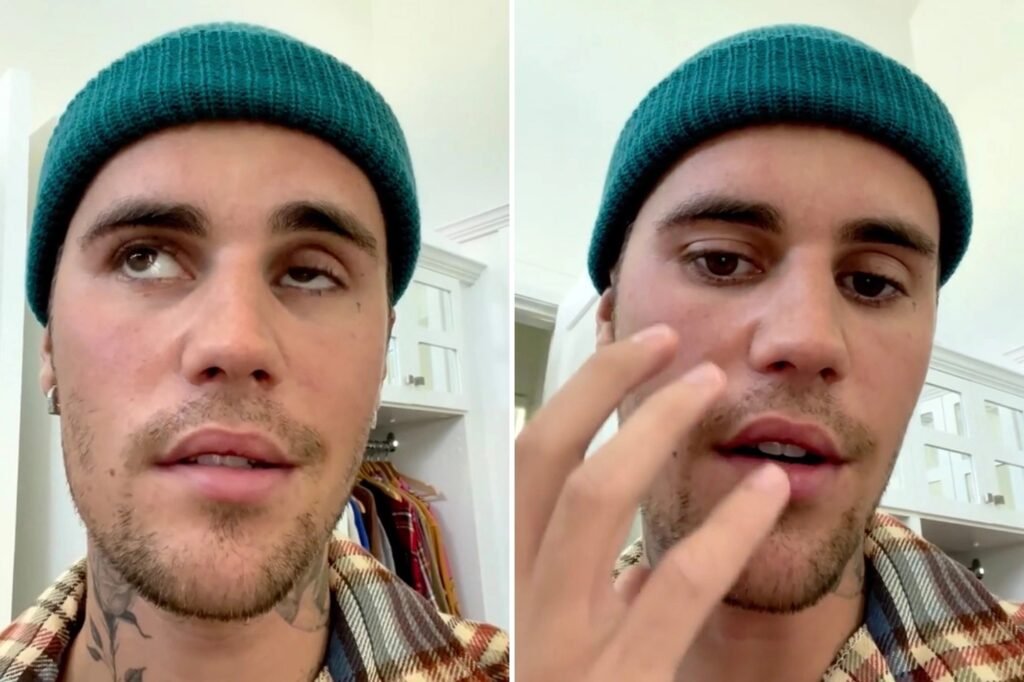 Justin Bieber has a rare syndrome that paralyzes his face: "Pray for me" (video)