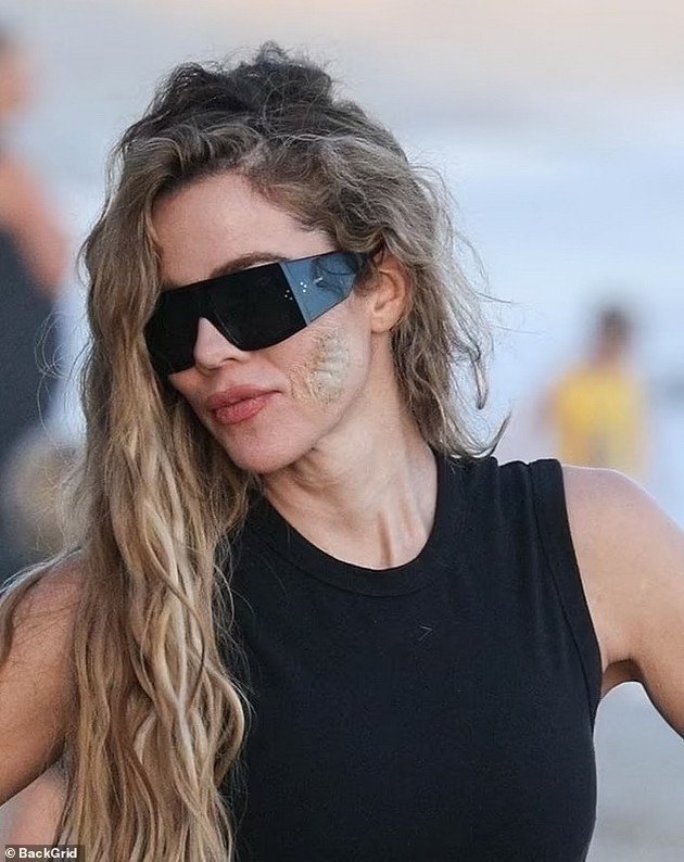 Khloé Kardashian showed the wound from the removal of the tumor on the face