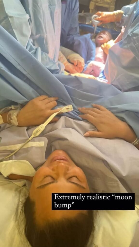 Chrissy Teigen's Shocking Instagram Post Reveals Intimate Details of C-Section Birth!