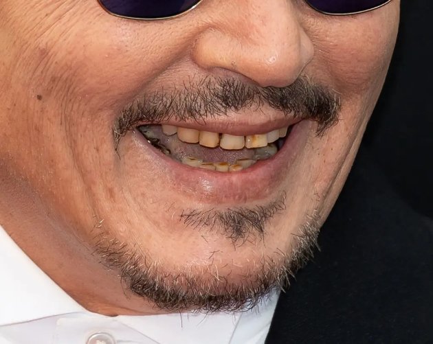 Unrecognizable Smile: Johnny Depp's Yellowed Teeth Shock Fans