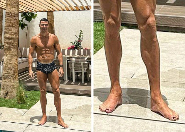 Why does Cristiano Ronaldo polish his toenails with black nail polish?