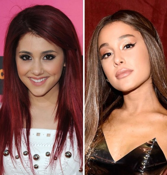 Ariana Grande Admitted That She Had A Lot Of Lip Fillers And Botox Before The Age Of 25