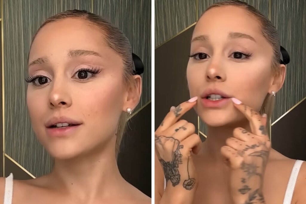 Ariana Grande Admitted That She Had A Lot Of Lip Fillers And Botox Before The Age Of 25