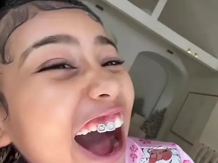 North West Shows Off Diamond Teeth On TikTok