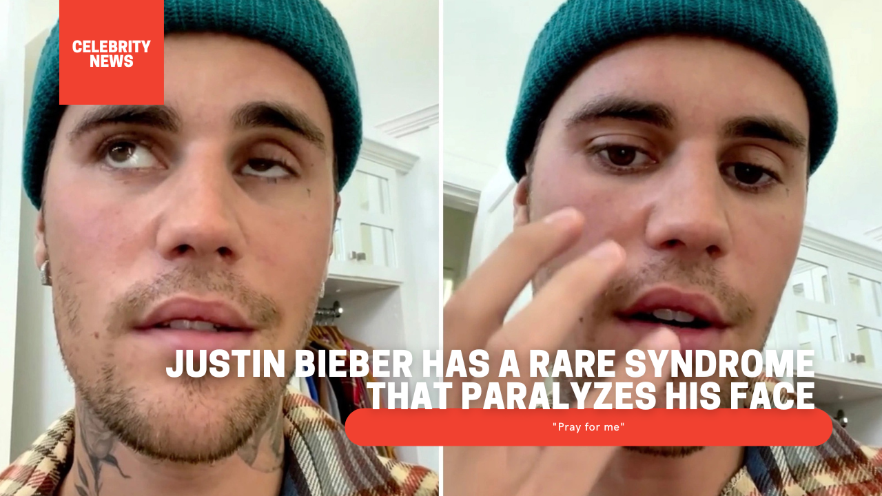 Justin Bieber has a rare syndrome that paralyzes his face: "Pray for me" (video)