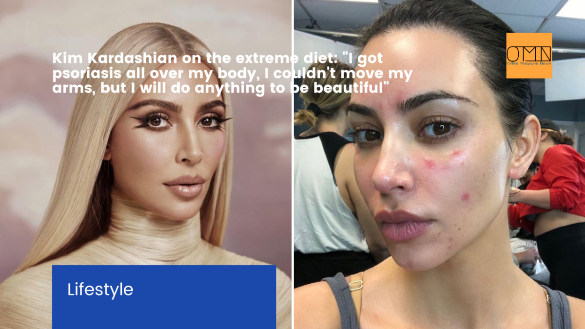 kim-kardashian-on-the-extreme-diet-i-got-psoriasis-all-over-my-body